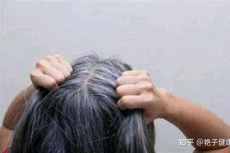 梦见他人满头白发的预兆