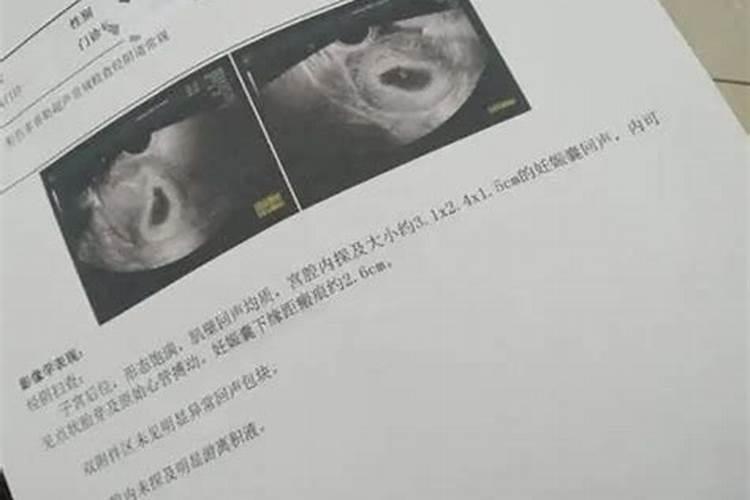 之前人流后老是哭!现在好像声音沙哑的恢复不了原来的声音!这个人流没保 ...