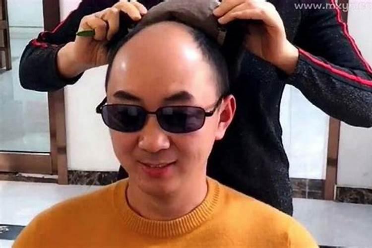 梦到自己秃头是什么预兆