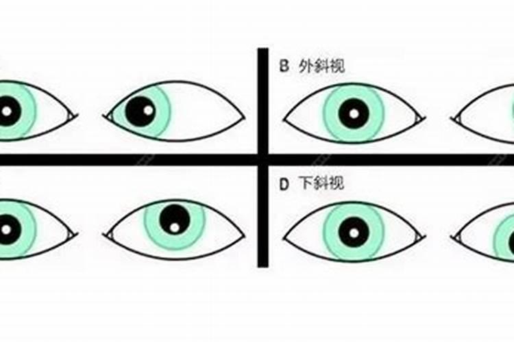 在命理风水上是怎么解释人有一只眼睛是斜眼的