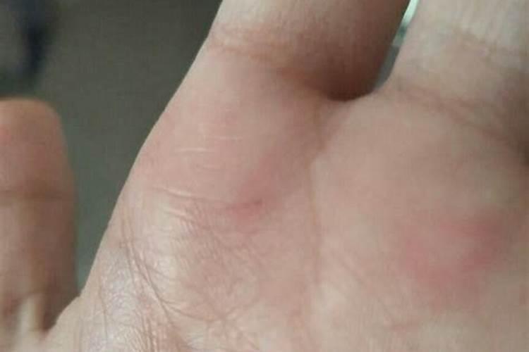 梦到手被划破了流血了