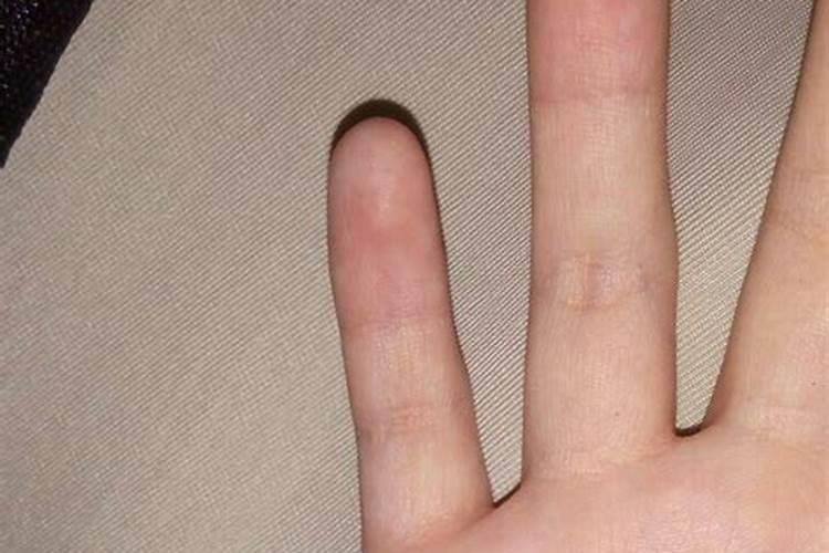 梦见手被划了一道口子的预兆